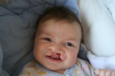 20090413100839-sonrisa-de-hugo.jpg